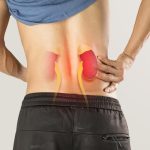 Κολικός νεφρού