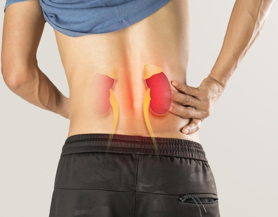 Κολικός νεφρού